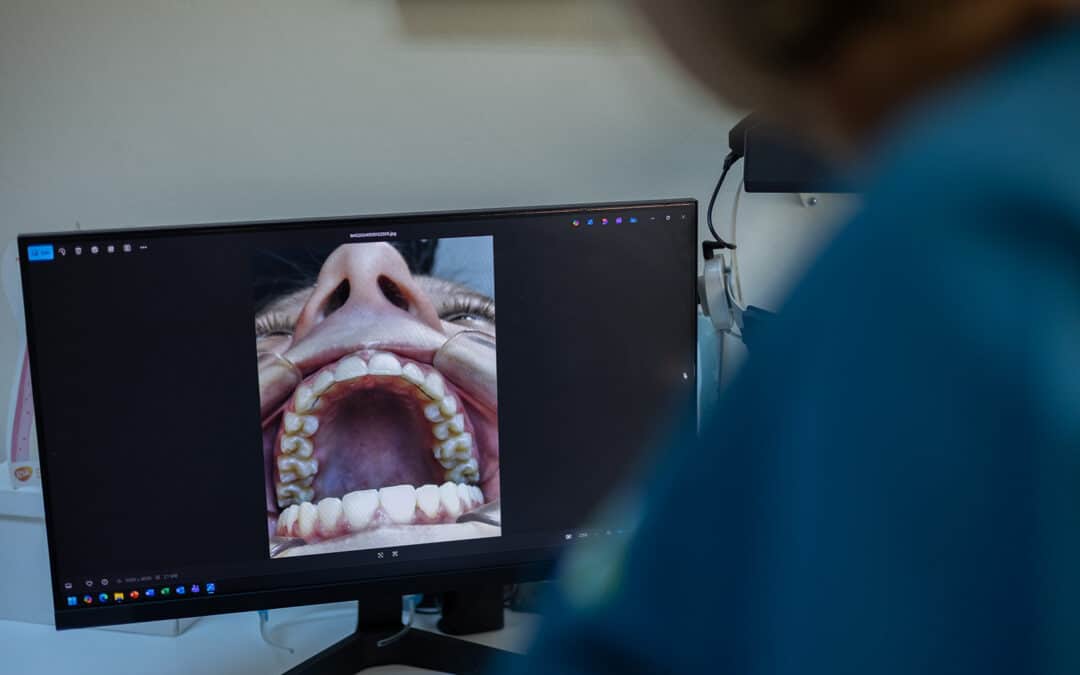 Affordable Teeth Braces: What Are Your Options?