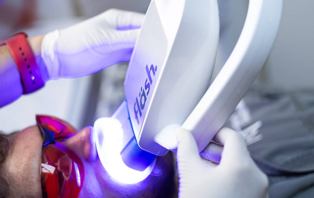 Whitening Teeth Dentist: Why Choose a Dental Professional for Teeth Whitening?